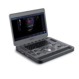 SONOSCAPE X5V
